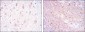 CD1A Antibody